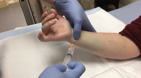 Ulnar Nerve Block at the Wrist