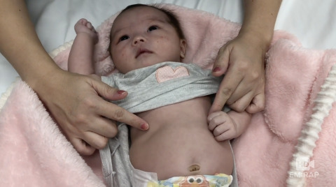 Infant with Retractions