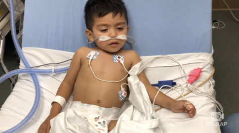 High Flow Nasal Cannula