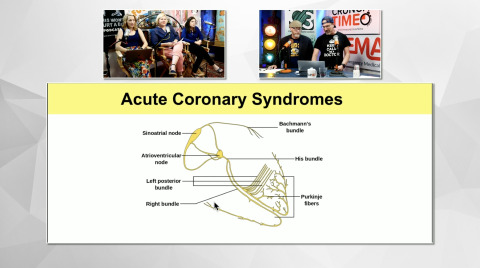EM:RAP Live: June 2018 > ECG Course: ACS Part 2