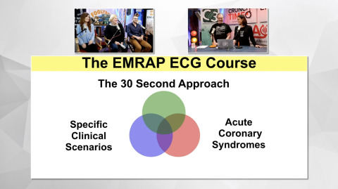 EM:RAP Live: November 2018 > ECG Course: The Paced ECG