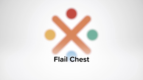 Flail Chest
