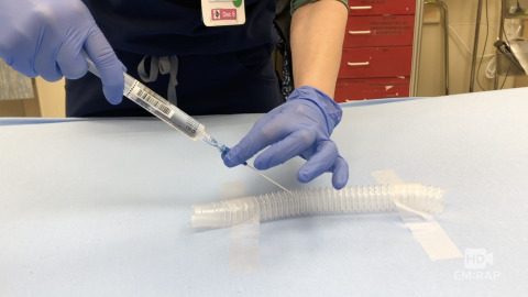 Percutaneous Transtracheal Ventilation Setup