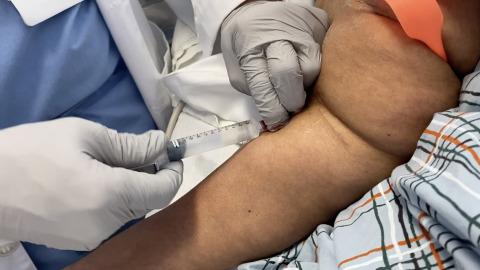 IV Placement in Patient with Loose Skin