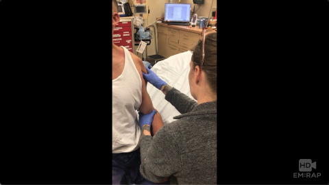 Cunningham Shoulder Reduction Technique