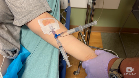 Two-Syringe Method for Adenosine Administration