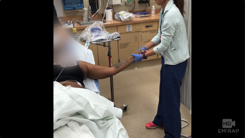 FARES Shoulder Reduction Technique