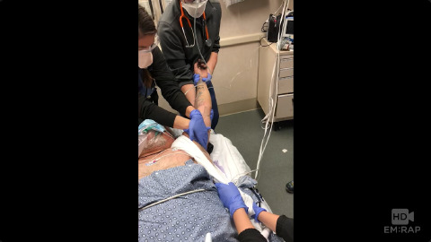 Reduction of an Inferior Shoulder Dislocation