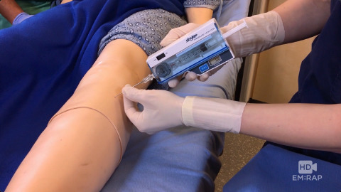 Measuring Compartment Pressure