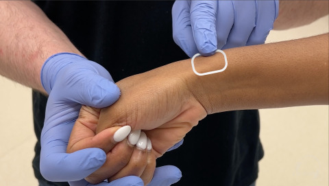 Finkelstein Test for De Quervain Tendinopathy