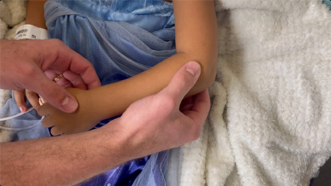 Nursemaid's Elbow Reduction with Hyperpronation