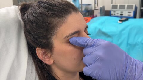 Digital Ocular Massage