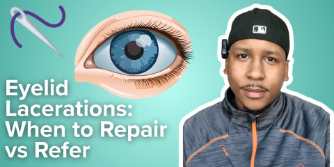 Daily Dose 2026 February 10: Eyelid Lacerations: When to Repair vs Refer