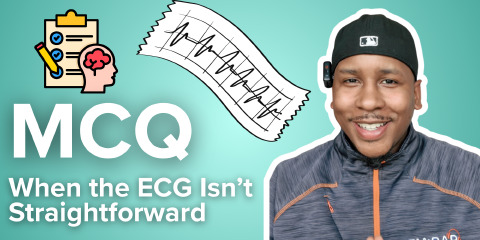 Daily Dose 2026 February 24: MCQ: When the ECG Isn’t Straightforward