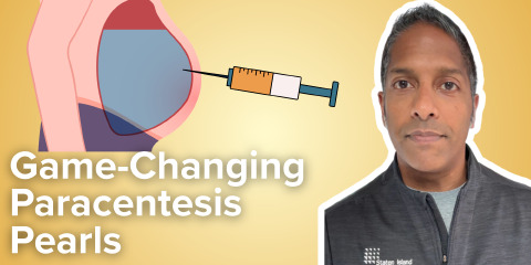 Daily Dose 2026 March 24: Game-Changing Paracentesis Pearls