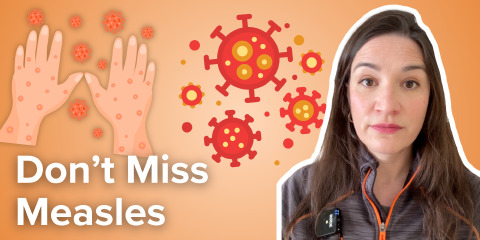 Daily Dose 2026 April 3: Don’t Miss Measles