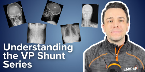 Daily Dose 2026 June 5: Understanding the VP Shunt Series