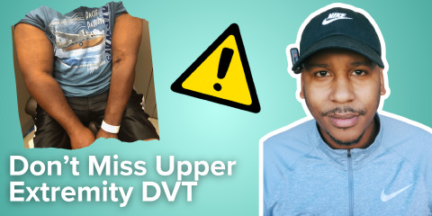 Daily Dose 2026 July 3: Don’t Miss Upper Extremity DVT