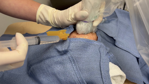 Ultrasound-Guided Wrist Arthrocentesis
