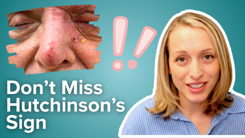 Daily Dose 2026 August 25: Don’t Miss Hutchinson’s Sign