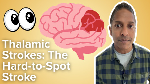 Daily Dose 2026 September 29: Thalamic Strokes: The Hard-to-Spot Stroke