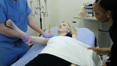 Anterior Shoulder Dislocation (Simulated Reduction)