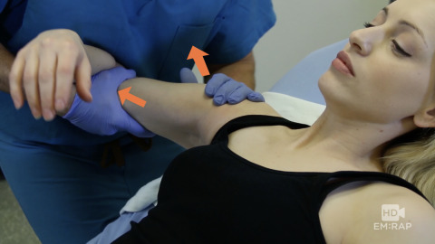 Posterior Shoulder Dislocation (Simulated Reduction)