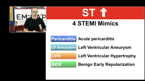 EM:RAP Live: December 2016 > ECG Course: ST Elevation Part 2
