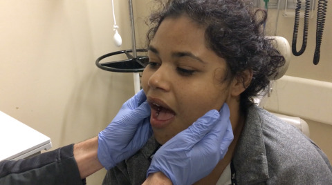 Jaw Reduction by Extraoral Technique - Presented by Jess Mason