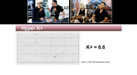 EM:RAP Live: August 2017 > ECG Course: The Terrible T Waves